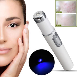 Blue Light Treatment Pen for Scar Wrinkle Acne - doctorlukeshop